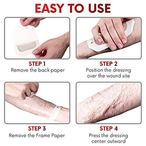 Transparent Film Dressing,  4