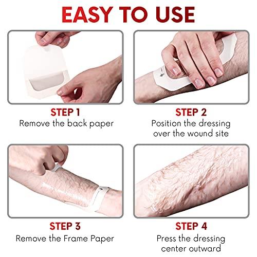 Transparent Film Dressing, 4