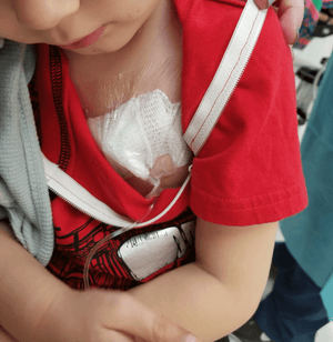 PLAIN CHILD Port Access